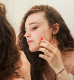 5 cuidados para aliviar os sintomas de dermatite perioral