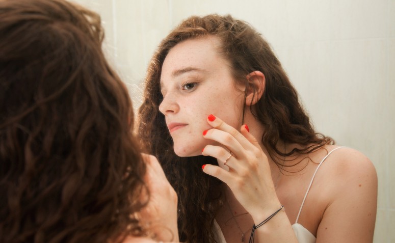 5 cuidados para aliviar os sintomas de dermatite perioral