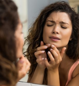 Saiba como lidar com uma espinha inflamada